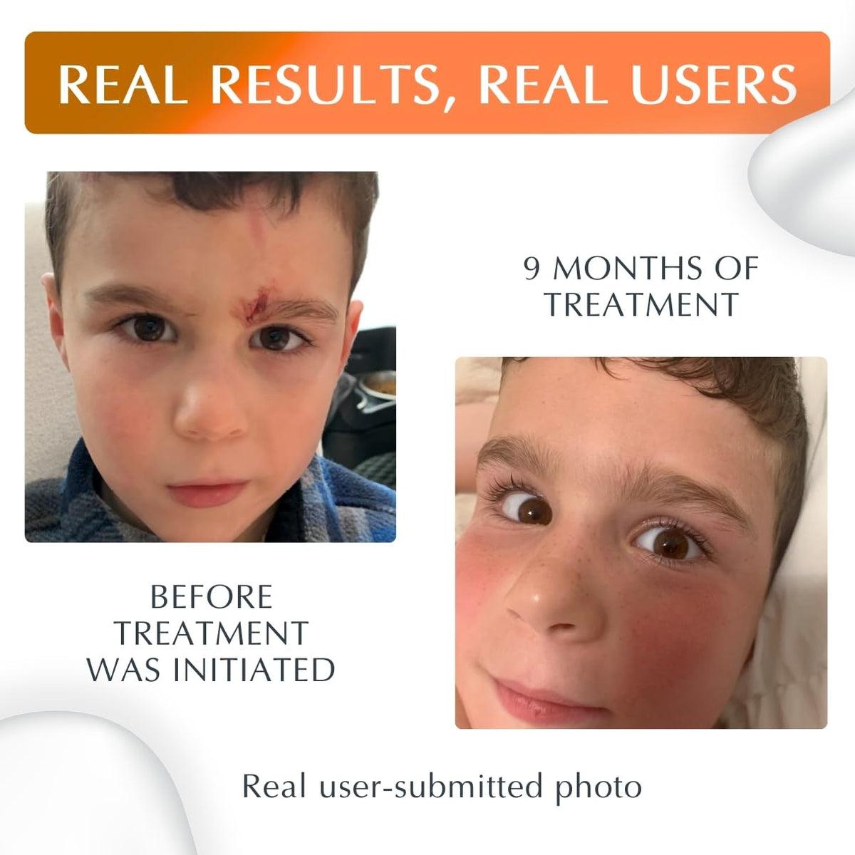 MyNewGel applied on hand to show easy targeted application and protection