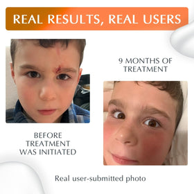 MyNewGel applied on hand to show easy targeted application and protection