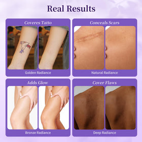 MyTend being applied on arm highlighting concealment benefit