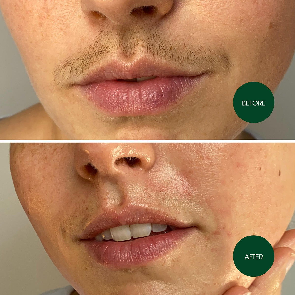 Nad's strip with gentle moisturizer for soothing aftercare and calm skin