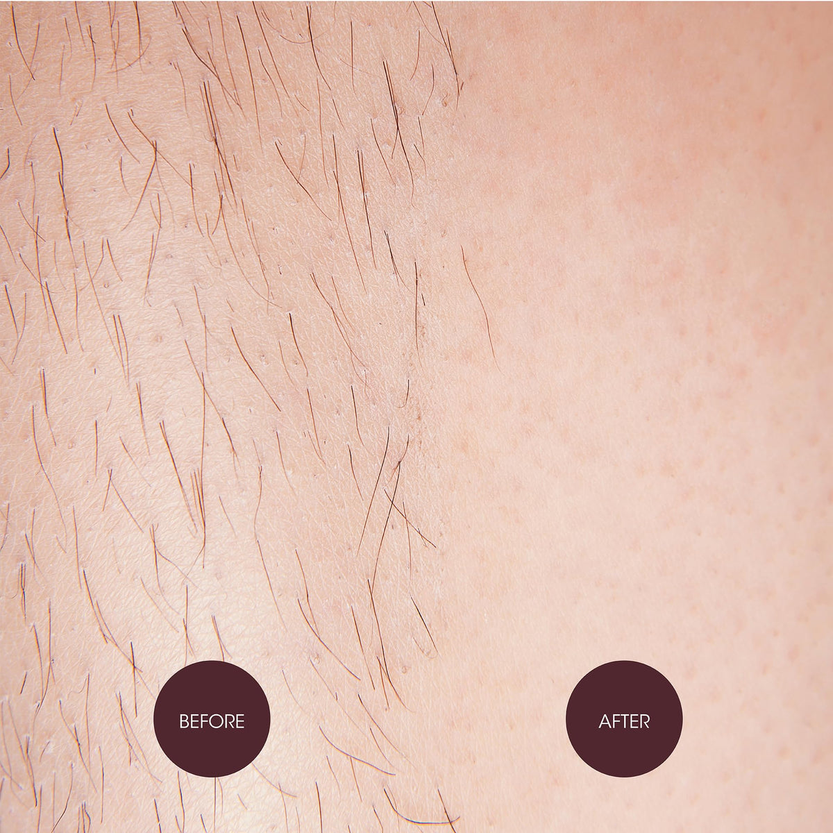 Nad's application demo on bikini area illustrating correct spread and removal