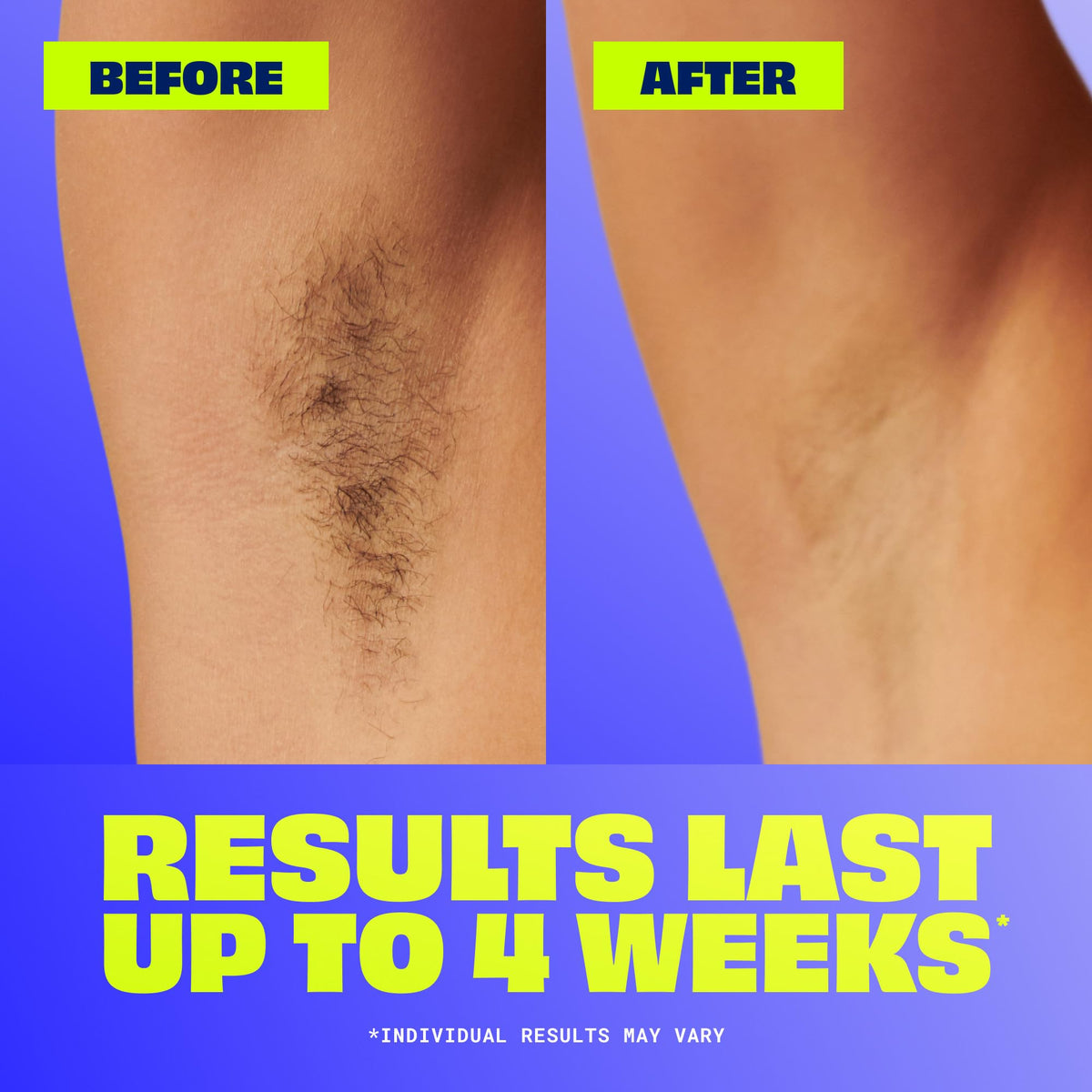 Nair before-and-after legs comparison displaying smooth, hair-free results
