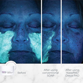 NassifMD pad close-up texture demonstrating soft, thin material