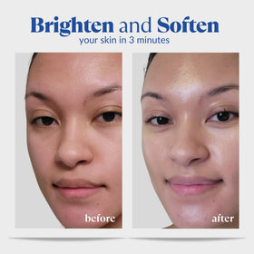 NATURAL AQUA GEL CURE being massaged on face to lift dull skin