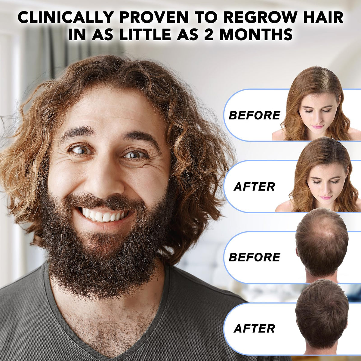 NATURE ZIRAN applying drops to scalp illustrating targeted use