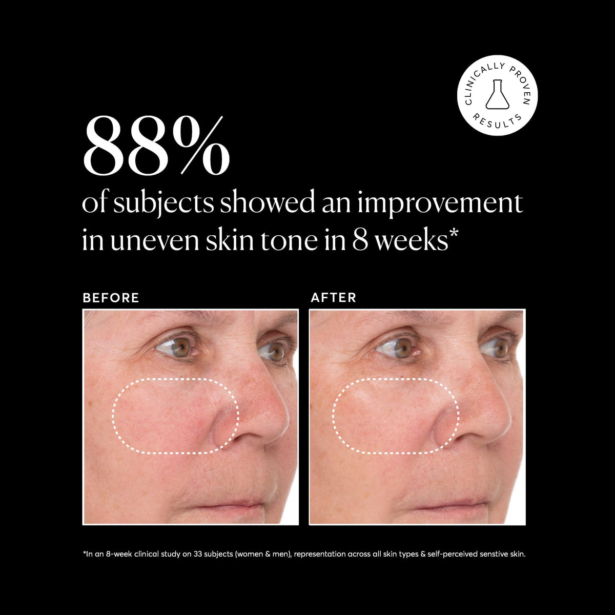 Applying Naturium serum on cheek to show lightweight absorption benefit