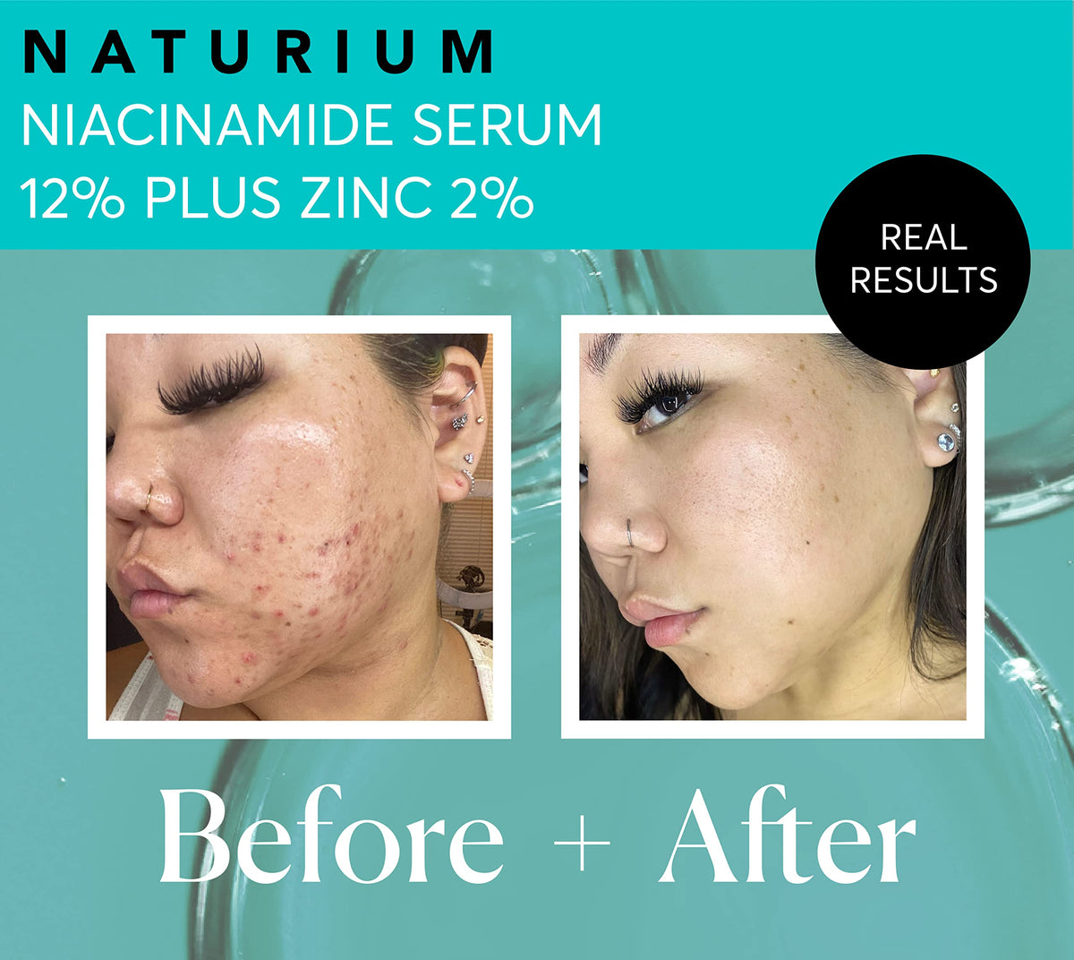 Naturium ingredient label showing niacinamide and zinc concentrations for transparency