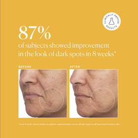 Naturium serum applied on skin illustrating easy absorption and finish