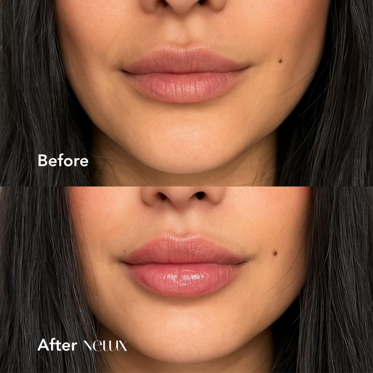 Nelux applicator closeup highlighting precise tip and easy application