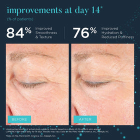 NEOCUTIS simulated before-and-after eye area showing improved look and radiance