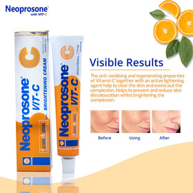 Neoprosone applied during nighttime routine supporting targeted brightening