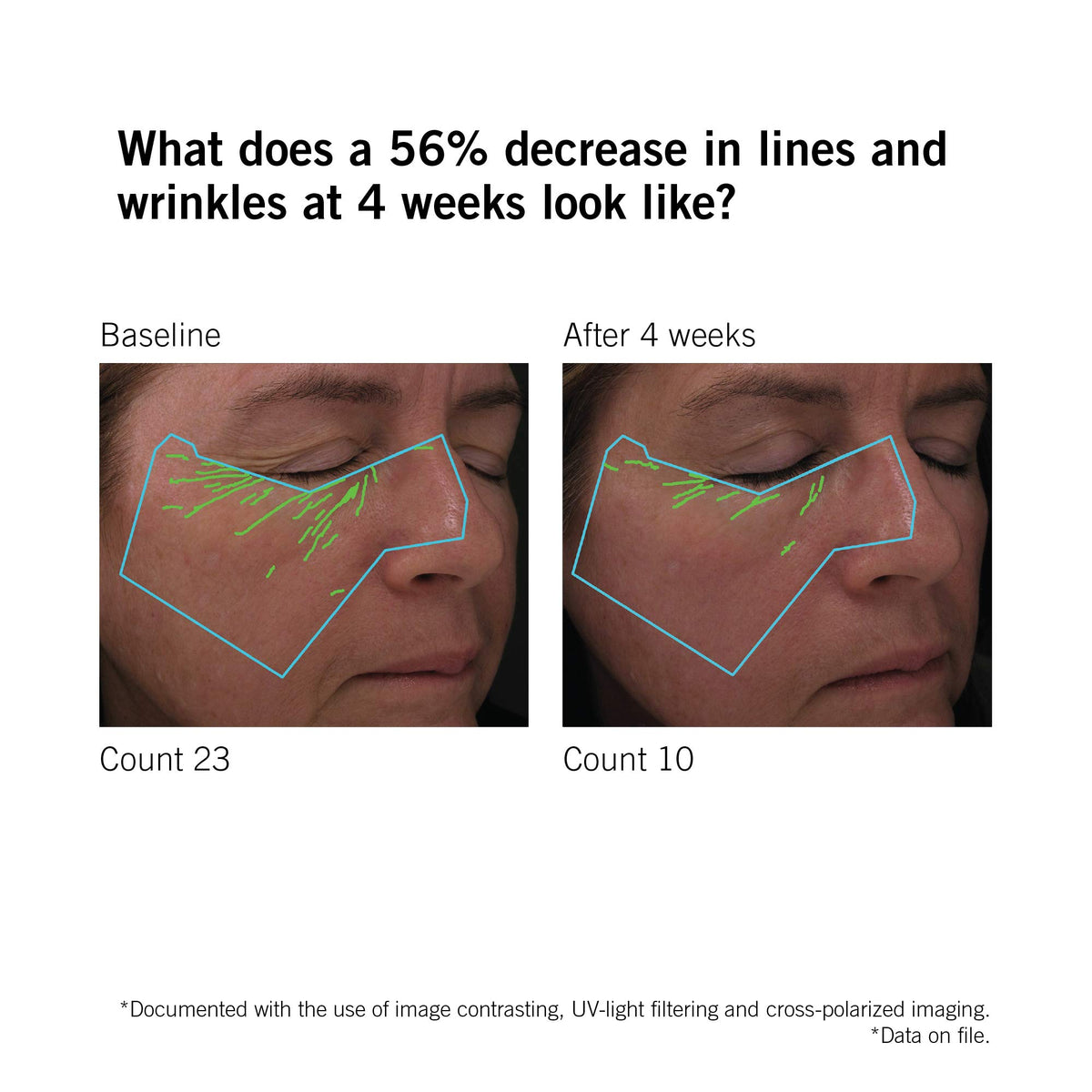 NEOVA serum on hand lifestyle shot demonstrating fast-absorbing finish