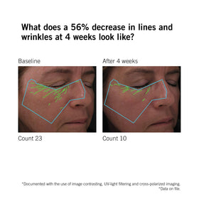 NEOVA serum on hand lifestyle shot demonstrating fast-absorbing finish