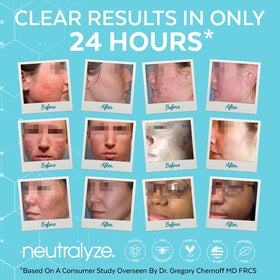 Neutralyze pad being wiped on face demonstrating quick treatment