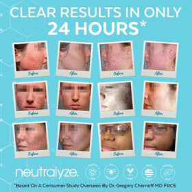 Neutralyze on hand scale displaying 3.4 fl oz bottle size for travel convenience