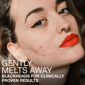 Neutrogena close-up acid complex graphic illustrating exfoliating action