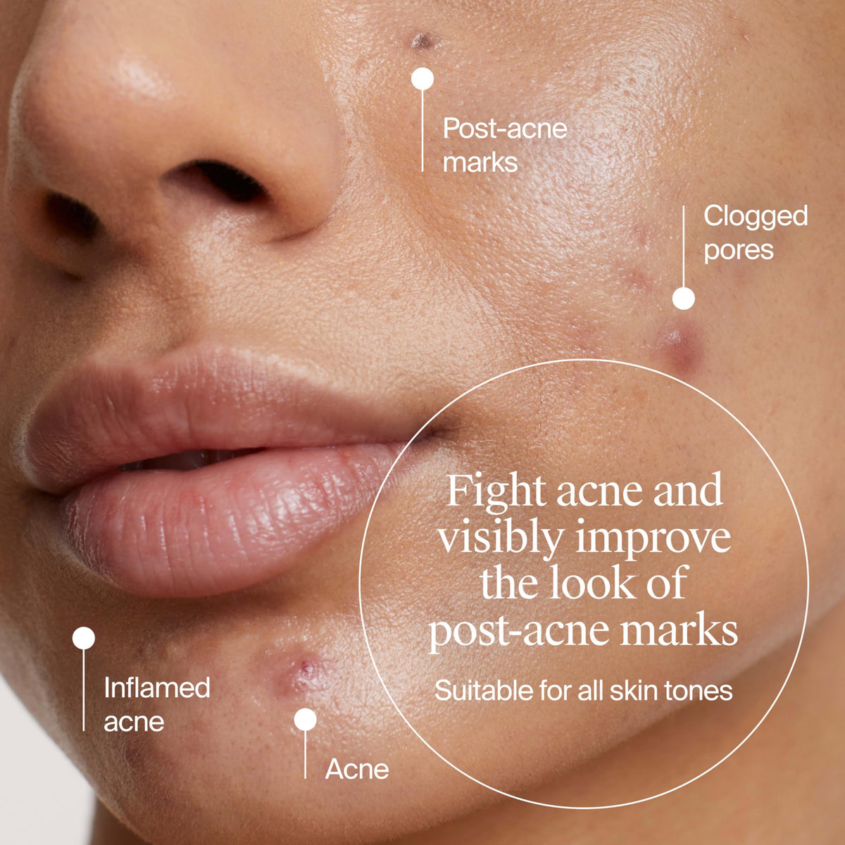 Neutrogena gel texture swirl showing lightweight absorption benefit