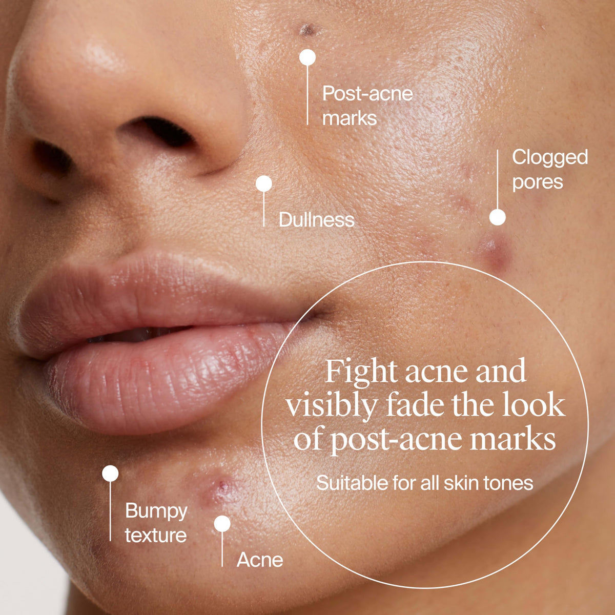 Neutrogena serum poured on hand demonstrating easy application