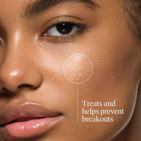 Neutrogena foam lather on hand illustrating gentle cleansing and quick rinse