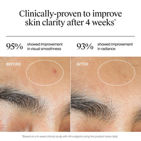 Neutrogena gel on model skin illustrating quick absorbency benefit