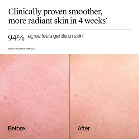 Neutrogena gel texture close-up displaying lightweight hydrating formula