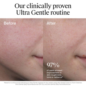 Neutrogena CICA ingredient illustration highlighting soothing and calming benefit