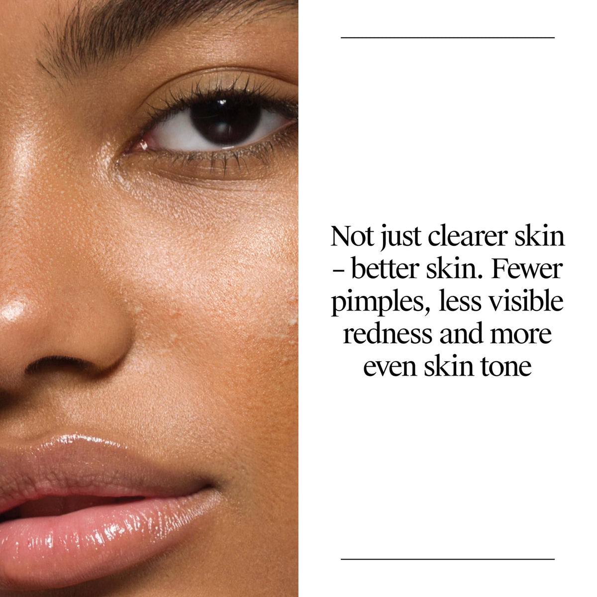 Neutrogena salicylic acid ingredient visual emphasizing pore-penetrating action