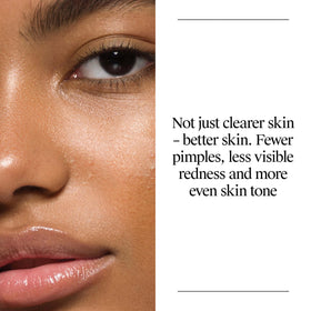 Neutrogena salicylic acid ingredient visual emphasizing pore-penetrating action