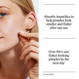 Neutrogena patches applied on cheek demonstrating overnight blemish protection