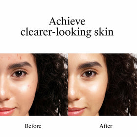 Neutrogena gel texture close-up showing smooth formula for targeted use