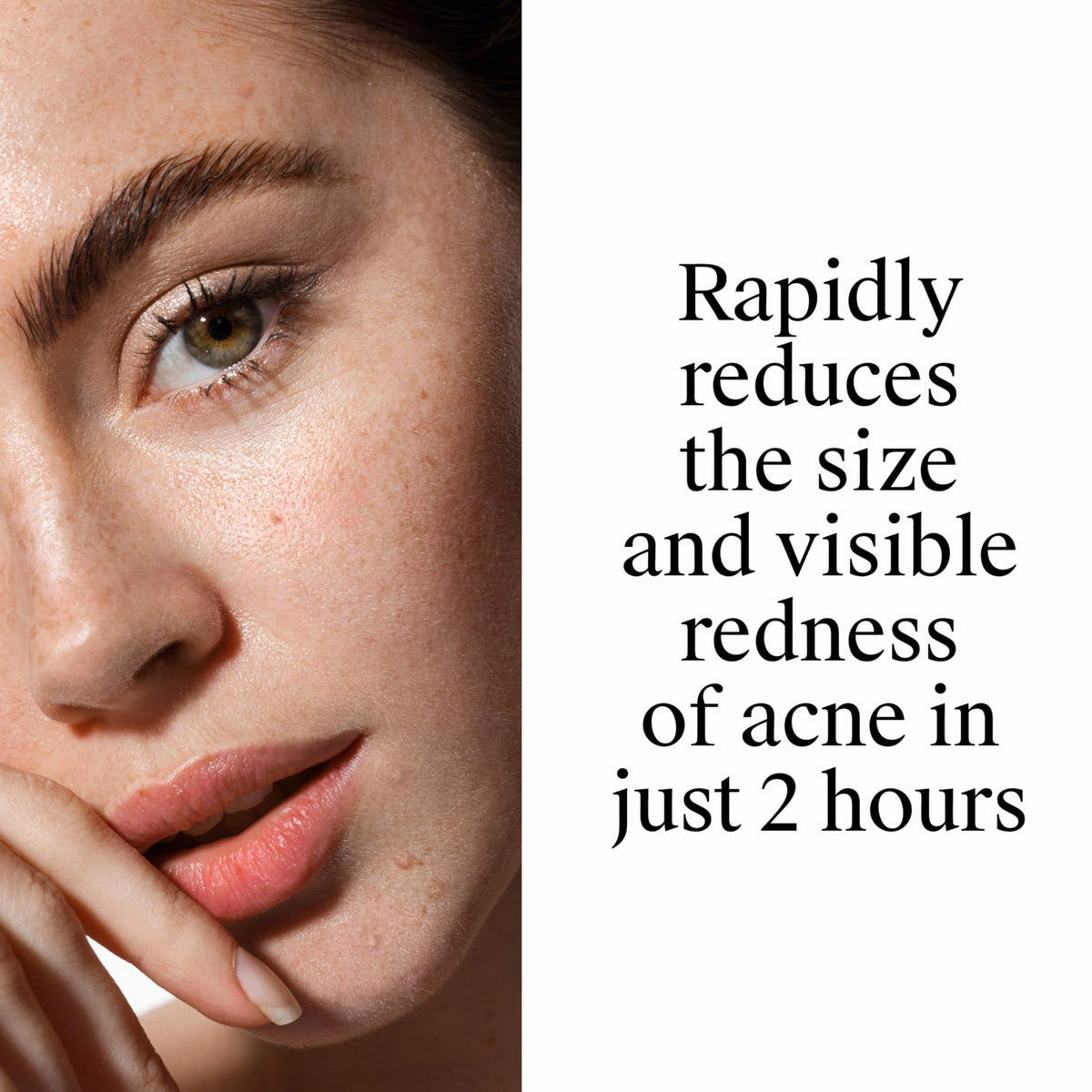 Neutrogena packaging label detail showing 10% benzoyl peroxide strength