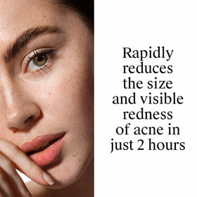 Neutrogena packaging label detail showing 10% benzoyl peroxide strength