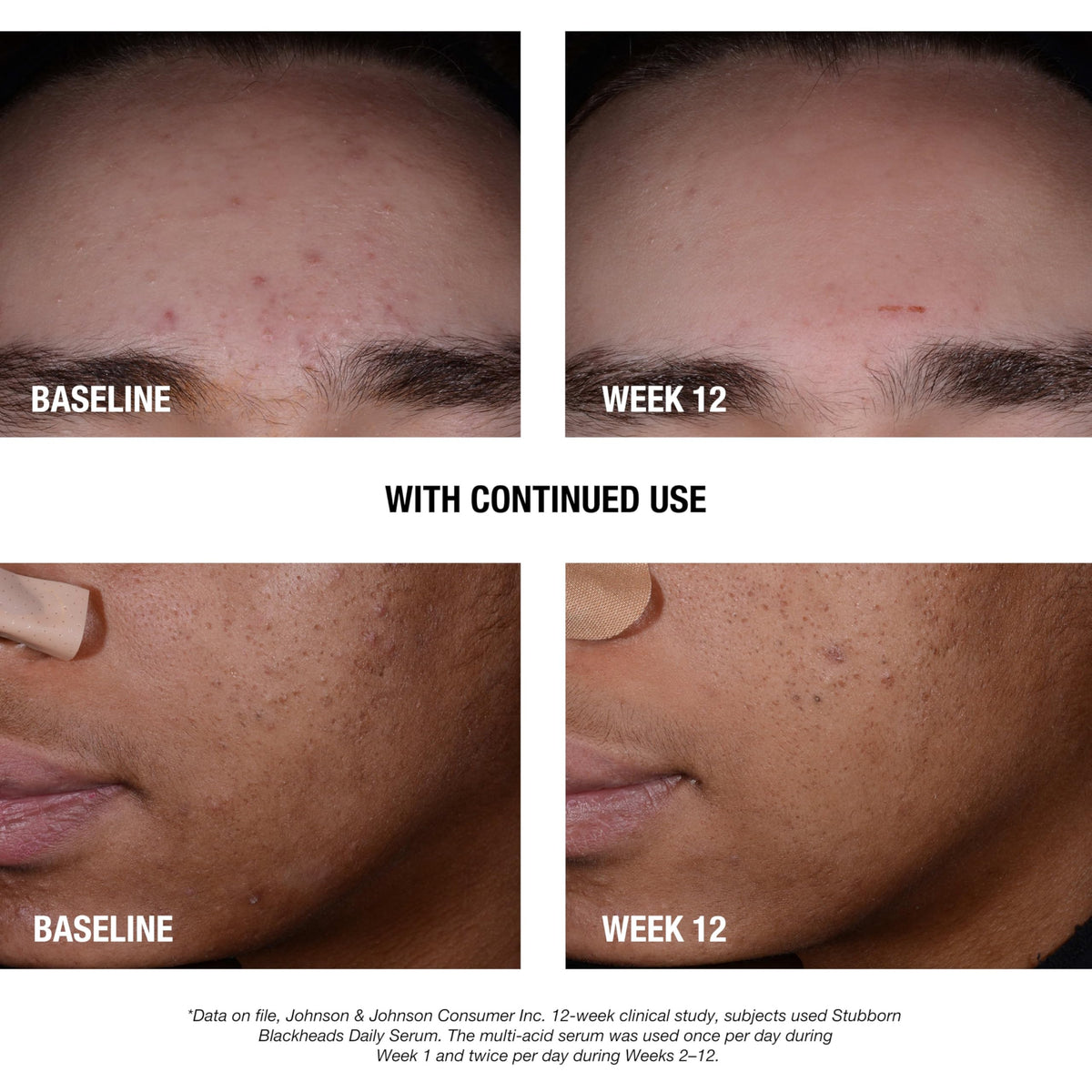 Neutrogena serum texture on fingertip showing lightweight, non-greasy finish