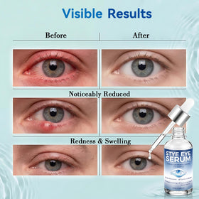 Nexkayee serum close-up texture demonstrating lightweight, fast-absorbing consistency