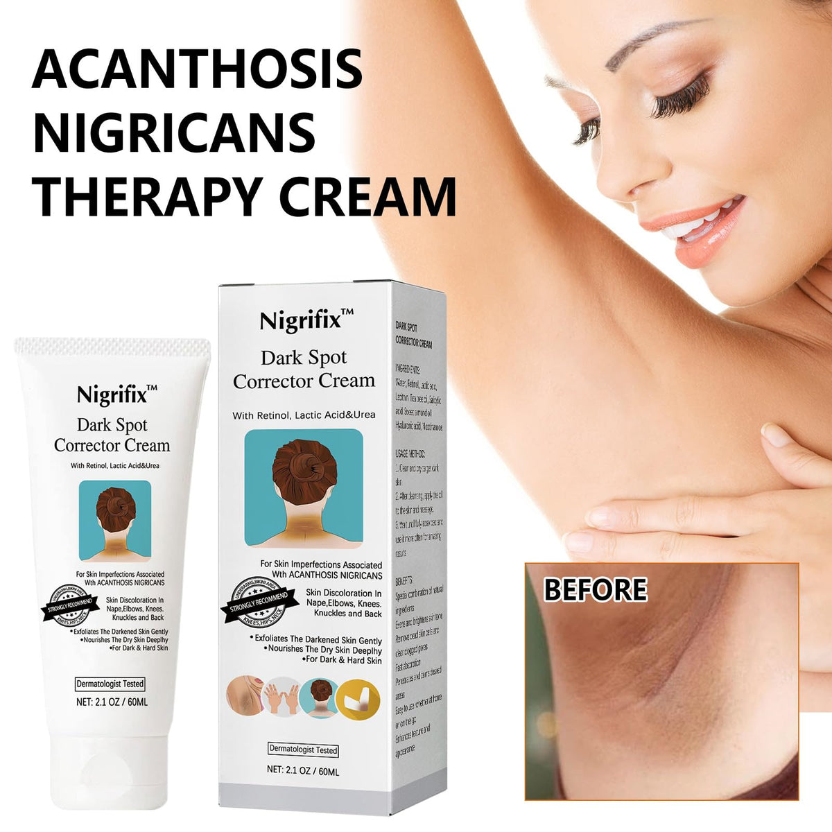 Nigrifix applied to underarm illustrating gentle targeted dark spot care