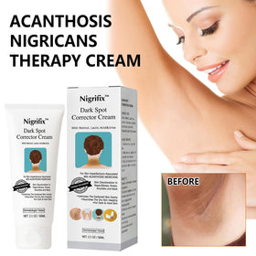 Nigrifix applied to underarm illustrating gentle targeted dark spot care