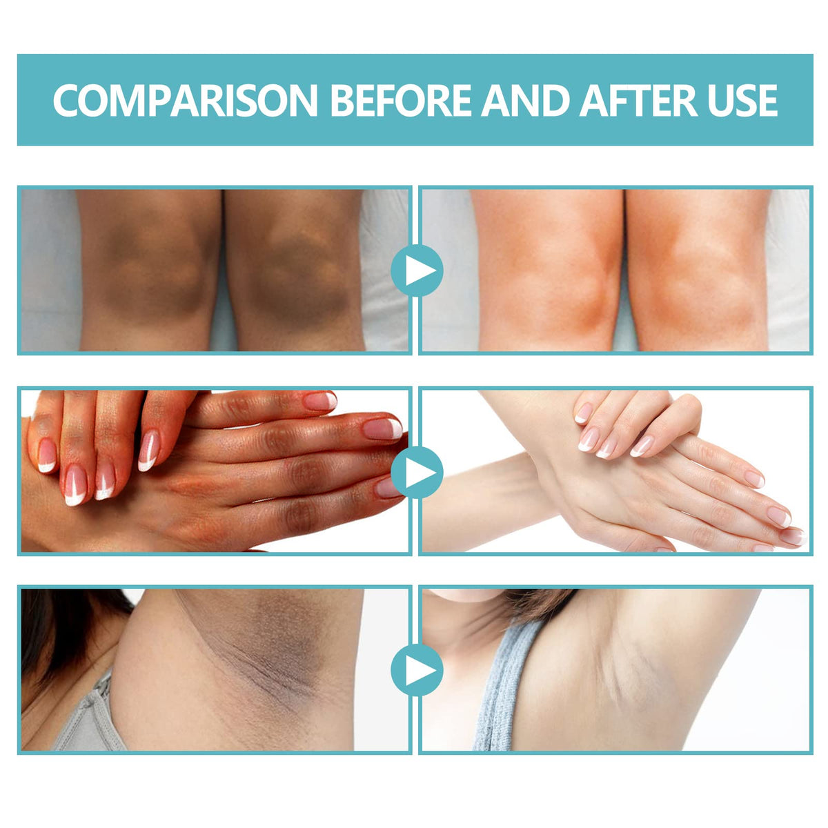 Nigrifix ingredient label highlighting retinol and lactic acid benefits