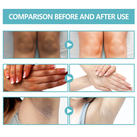 Nigrifix ingredient label highlighting retinol and lactic acid benefits
