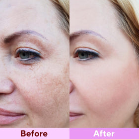 Nityrliv pack size scale showing eight masks for weekly overnight treatments