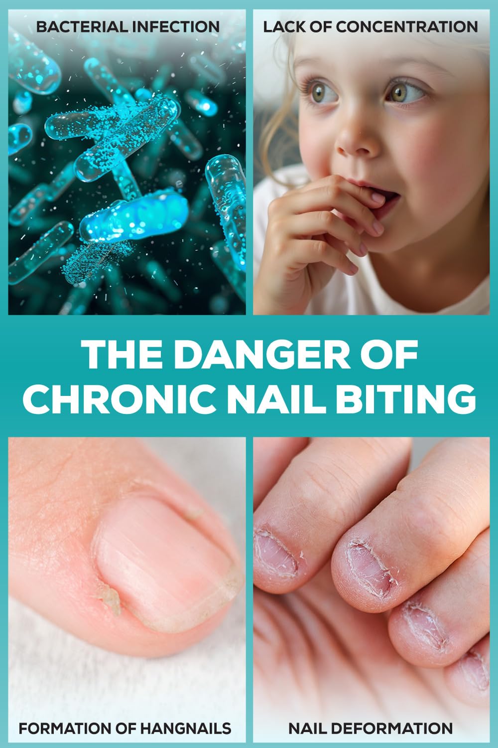 NIXXIT applied to a toddler's thumb to prevent thumb sucking effectively