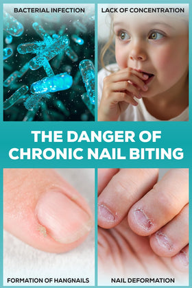 NIXXIT applied to a toddler's thumb to prevent thumb sucking effectively
