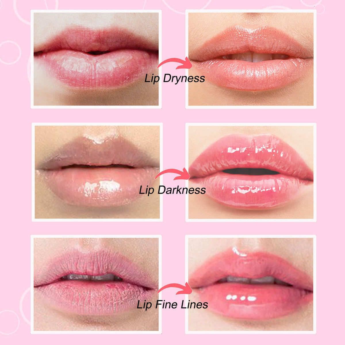 NIYET lip mask applied on lips demonstrating comfortable fit and instant moisturizing effect