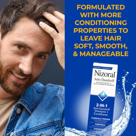 Nizoral hair before and after comparison showing reduced flakes and improved manageability