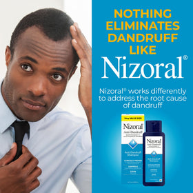 Nizoral bottle next to a hand for size comparison and travel readiness