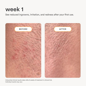 Nood ingredients display with ceramides and colloidal oatmeal boosting barrier benefit