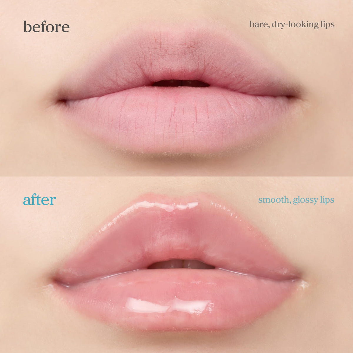 NOONI lips before and after showing fuller, hydrated pout