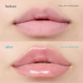 NOONI lips before and after showing fuller, hydrated pout