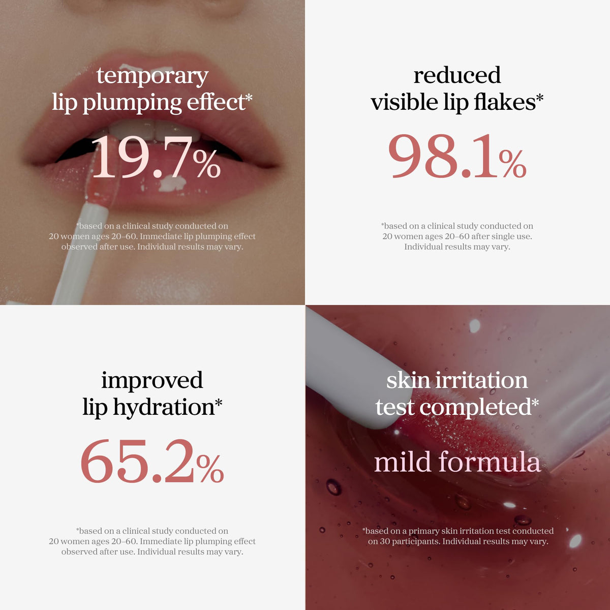 NOONI lips before and after showing visible smoother, fuller look