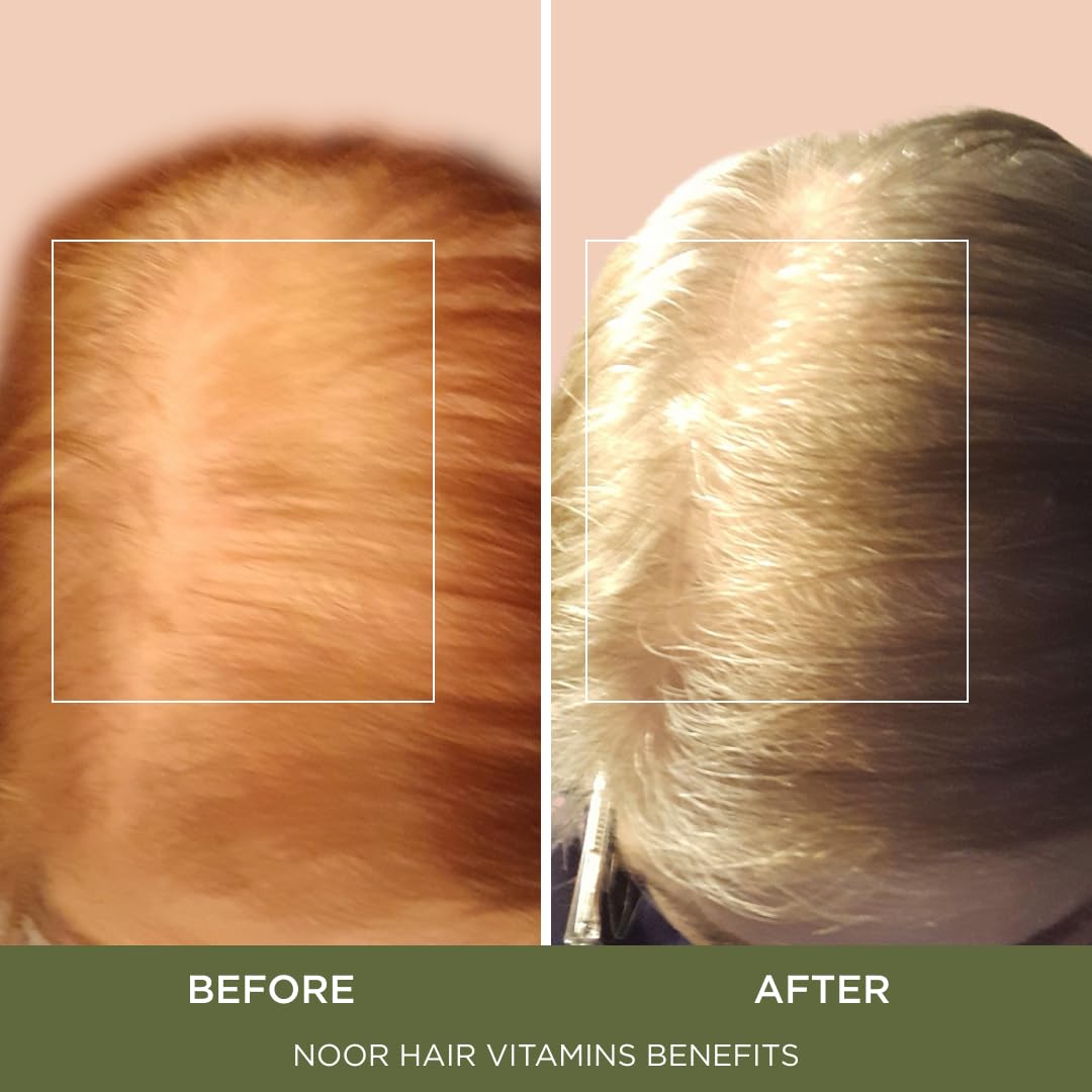 NOOR HAIR ingredients label with vitamins and minerals list for nutrient support