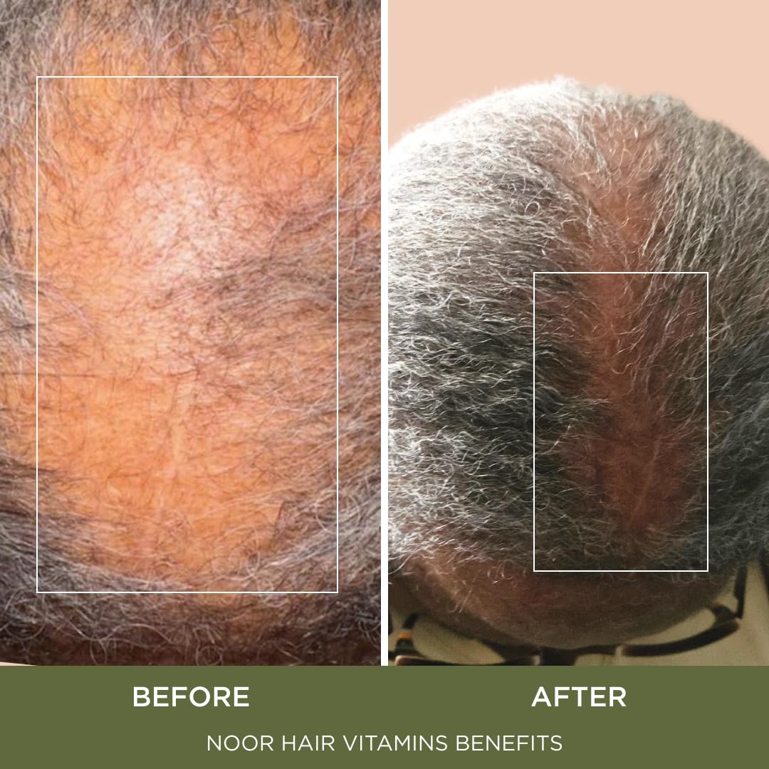 NOOR HAIR lifestyle photo of woman taking supplement showing convenient use